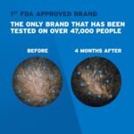 Men’s Rogaine 5% Minoxidil Foam – 1Month Supply - Image 4